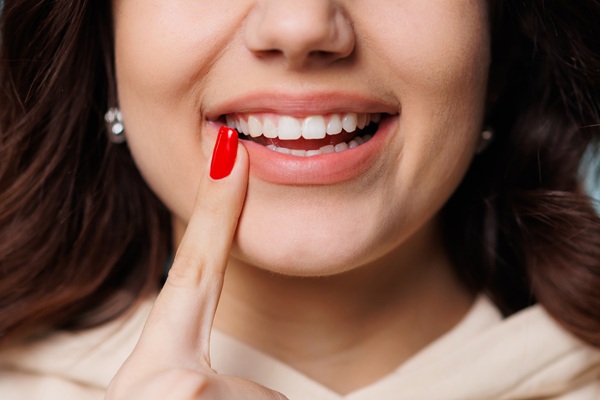 Ask A Cosmetic Dentist: Should I Choose Dental Bonding Or Veneers?