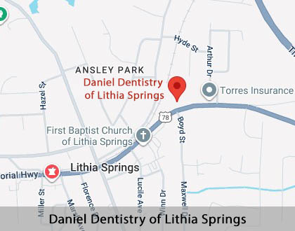 Map image for Options for Replacing Missing Teeth in Lithia Springs, GA