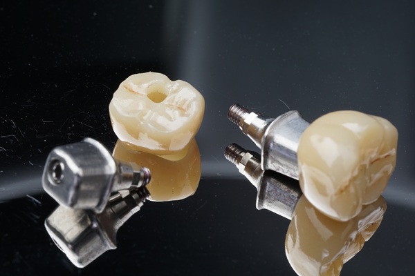 Making Your Implant Crowns Last